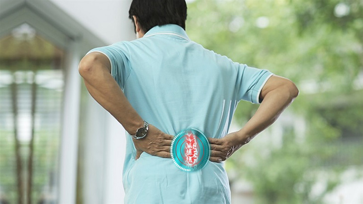 Dấu hiệu thoát vị đĩa đệm - Nhận diện sớm để điều trị hiệu quả