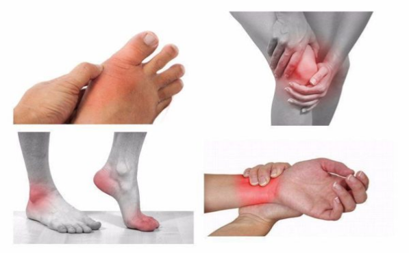 dấu hiệu đau cột sống