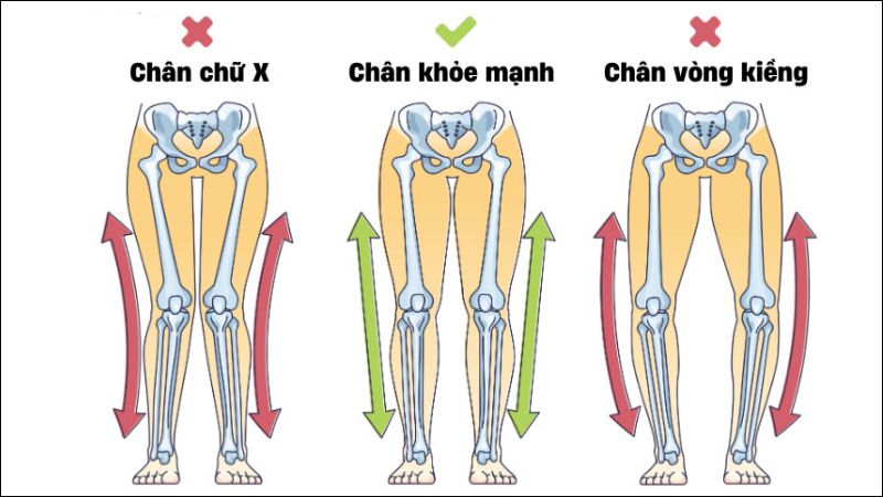 chan-vong-kieng